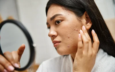 young-asian-woman-with-brunette-hair-and-pimples-l-2026-01-09-12-26-24-utc
